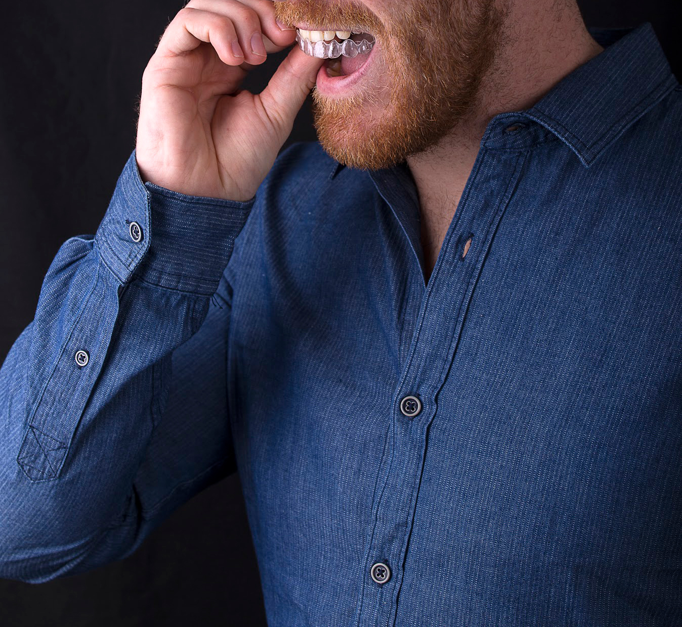 How long does an occlusal unloading splint last? Velez & Lozano