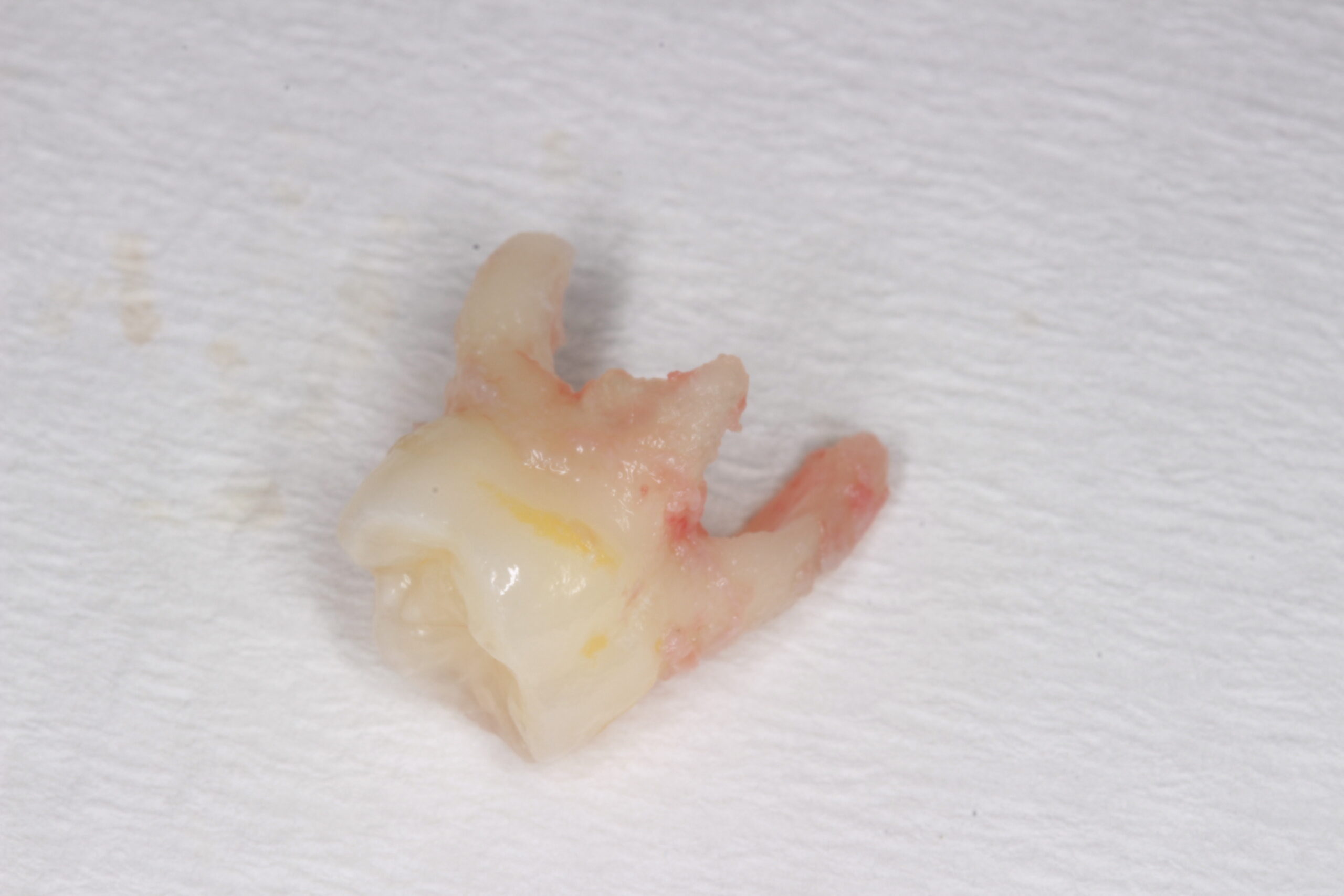 A baby tooth showing the root
